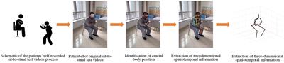 Exploring the potential of the sit-to-stand test for self-assessment of physical condition in advanced knee osteoarthritis patients using computer vision